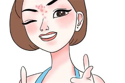 正规激光祛痘效果好不好 ？祛痘价格是多少？靓丽肌肤爱不释手！