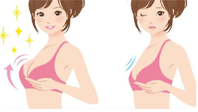 假体隆胸可以哺乳吗，假体隆胸的恢复期是多久呢？