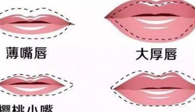 玻尿酸丰唇需要多少钱?能维持多久的时间?