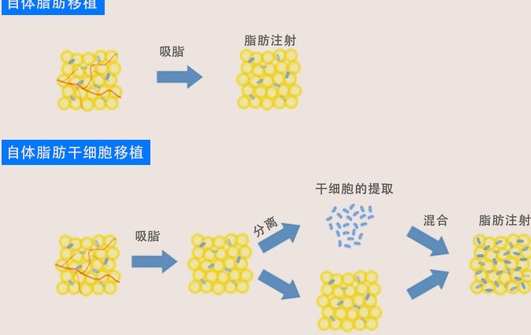 西安唐都医院陈辉怎么样？医生技术水平怎么样？案例反馈分享！