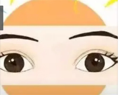 苏州刘武林双眼皮价格是多少？美眼案例分享