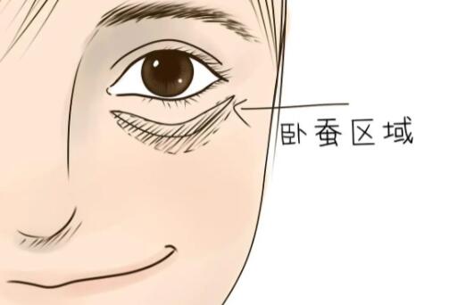 开个眼角和做卧蚕需要多少钱?适合哪些人做?戳进来看详细介绍