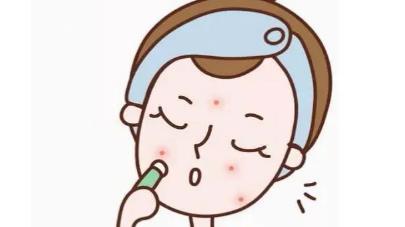 像素激光去痘坑效果怎么样？哪些值得了解，戳进来吧！
