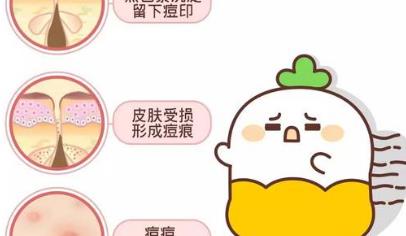 怎么去除痘坑？有哪些方式？以及术后如何护理？