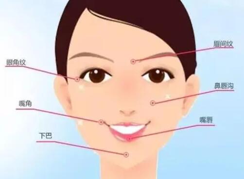 武汉乐美医疗美容门诊部玻尿酸价格大约是多少？医院实力点评|效果图展示！