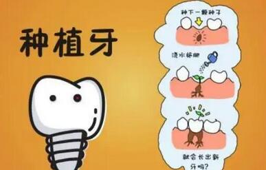 北京天坛医院种植牙多少钱？来看看具体的分享！