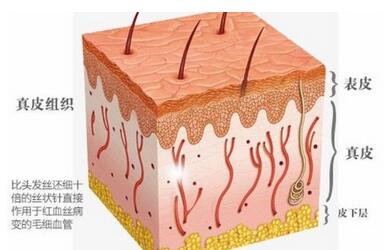 怎么样去除脸上红血丝？常用的几个小妙招分享！