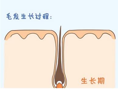 种植头发一般多少钱啊？做完植发后如何护理头皮