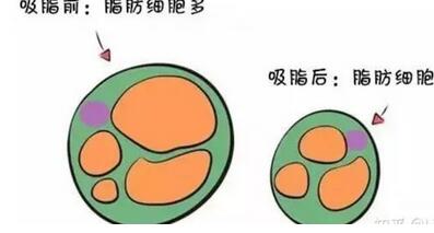 孕妇产后如何减肥？来了解下下面的分享~