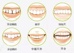 矫正牙齿的危害有哪些？口腔溃疡比较常见！附两种牙齿矫正方法介绍