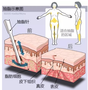 上海长征医院朱䴕割双眼皮怎么样？本院医生信息介绍、擅长项目点评攻略~