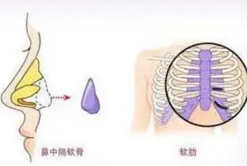 八大处杨晓楠医生怎么样？个人介绍、手法风格以及肋软骨隆鼻案例分享！