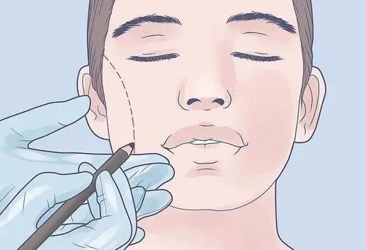 酒窝整形价格多少？贵吗？价格影响因素和整形方法揭秘！