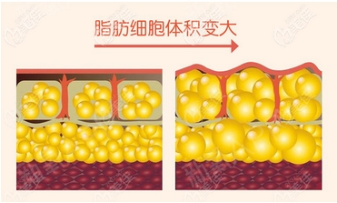 斯楼斌脂肪填充价格怎么样？医生、医院简介~擅长项目有哪些？