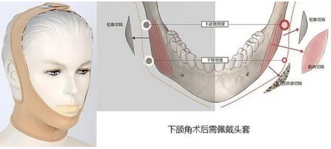 广大医院是三甲医院吗？医院|医生信息公开！除了下颌角整形还有哪些擅长项目呢？