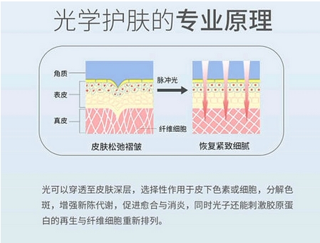 天津河东鑫伊颂医疗美容诊所光子嫩肤好不好？可以达到什么果？优点深入考察！