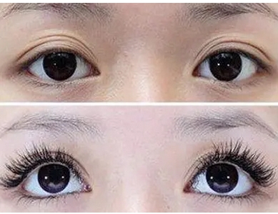 永久睫毛种植多少钱？注意事项有哪些？做“睫毛弯弯”大美女~