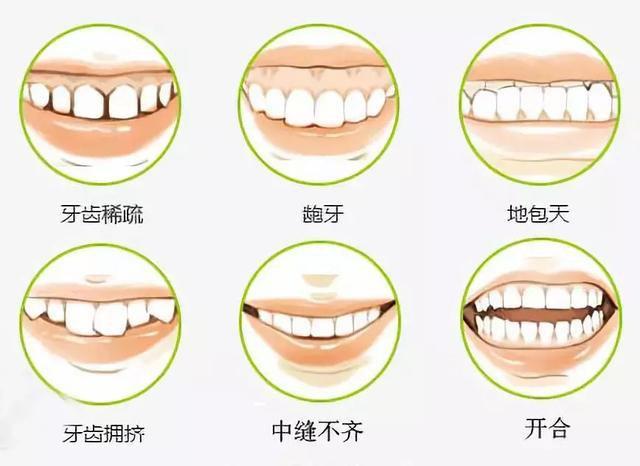 矫正牙齿疼不疼？会不会影响吃饭？矫正牙齿的方法汇总~