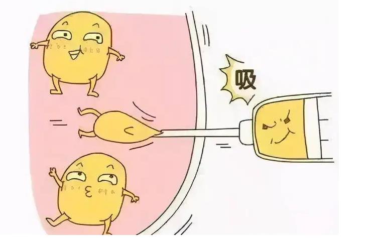 胳膊抽脂会不会反弹呀？效果好不好？注意事项必看~