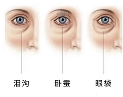 济南内切眼袋加泪沟价格怎么样？影响内切眼袋加泪沟价格因素有哪些？