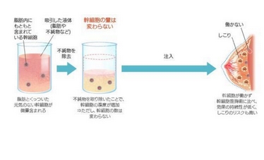 一次抽吸过多脂肪会怎么样？吸脂减肥会反弹吗？抽取方式_价格如何？ 