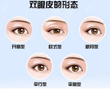 全切双眼皮多少钱啊？除了医院还有哪些影响价格？全切双眼皮有哪些优势的弊端？
