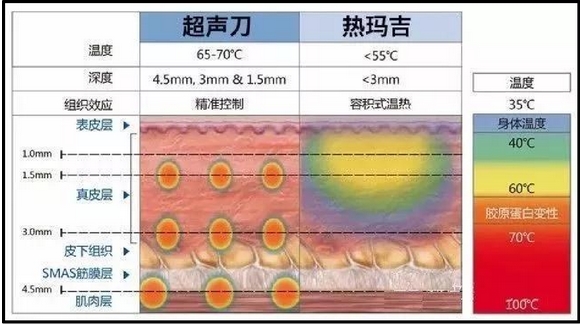 热玛吉和超声炮哪个提升果好？35岁_抗衰的心选项目~可以一起做吗？