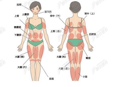 腹部吸脂痛吗？优势弊端有这些！转给身边减肥的朋友~ 