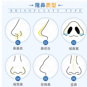 金华做鼻子好的医院排名如何？排行榜全部公开~重点介绍这十家医美机构！