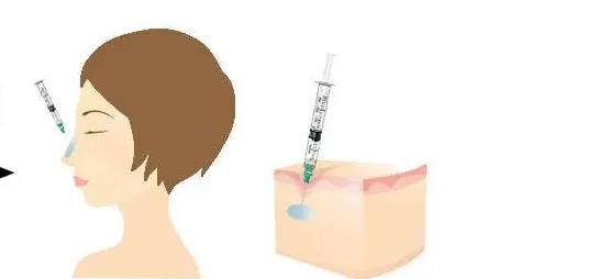 美立方做鼻子怎么样？那个医生做的好？上海医美介绍_王志刚等简介！