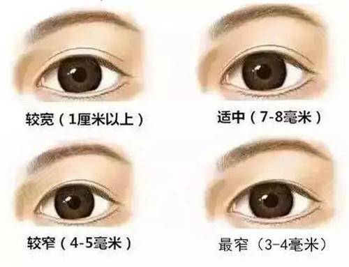 怎么预约到北京八大处的医生？于晓波、王太玲等专家简介_双眼皮案例！