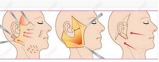 上海九院做皮肤扩张术好的医生有哪些？外科资料介绍_医生信息~附瘢痕修复案例！