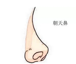 朝天鼻整形案例如何?实力案例全面盘点,“塌鼻星人”别错过!