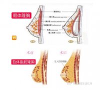 济宁名美整形医生介绍有哪些？几位大咖实力坐镇！医院信息-真实案例不容错过~