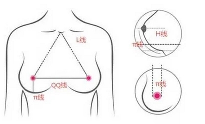 北京王驰隆胸怎么样？隆胸科普指南！美容简介-医生信息隆胸前必看~