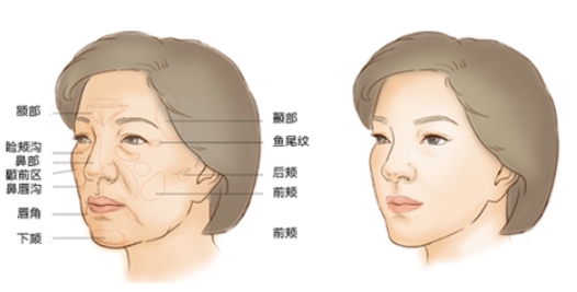 北京凯思米医疗美容怎么样？医生技术如何？特色项目-来院路线等你揭秘~