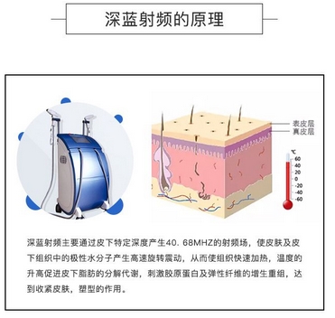 深蓝射频和热拉提区别有哪些？需要分别注意什么吗？抗衰新手必看攻略！