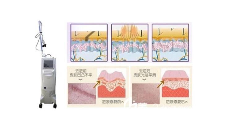 八大处整形医院李峰永怎么样？医生简介-疤痕修复案例展示！