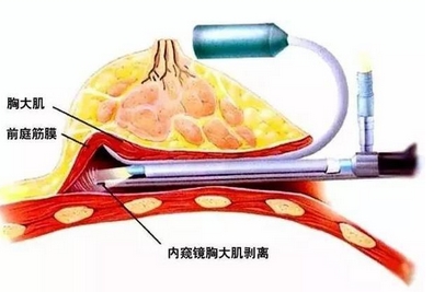 可玫尔医疗美容医院怎么样？医院实力，医生口碑技术快速get！