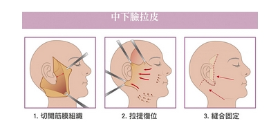 北京华韩拉皮手术怎么样？张齐等院内人气专家点评！让肌肤悄然回春~