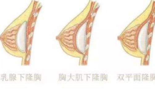 武汉协和医院易传勋怎么样？技术介绍，看分享附案例介绍~