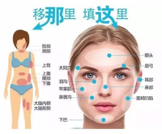 郑楚蓉脂肪填充怎么收费？水平怎么样？医生技术优势展现！