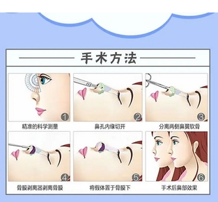 深圳美加美医疗美容怎么样价格表公开！医院实力|医生团队细节亲身体验！
