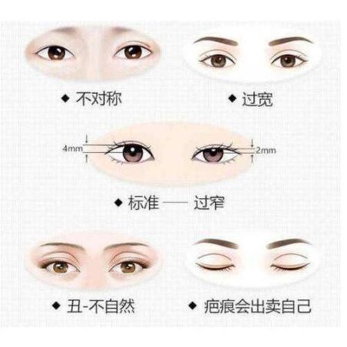 上海九院蒋朝华双眼皮修复怎么样？内附评价&挂号&收费价格