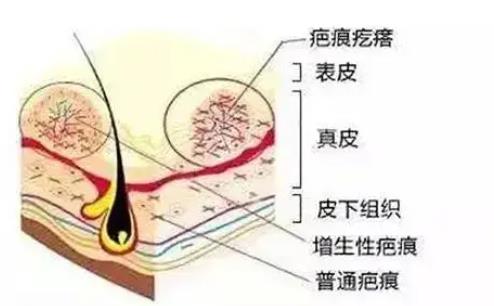 丁爽瘢痕综合调节很擅长吗？真实的技术如何？戳进来看看真人案例