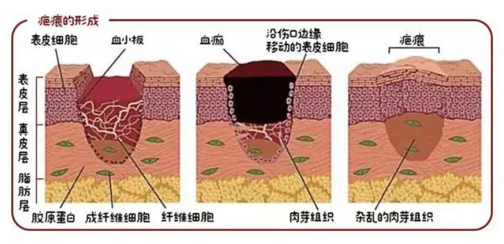 丁爽瘢痕综合调节很擅长吗？真实的技术如何？戳进来看看真人案例