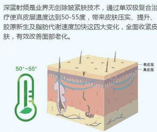 不开刀提拉上眼皮方法有哪些？射频和超声波比较火！