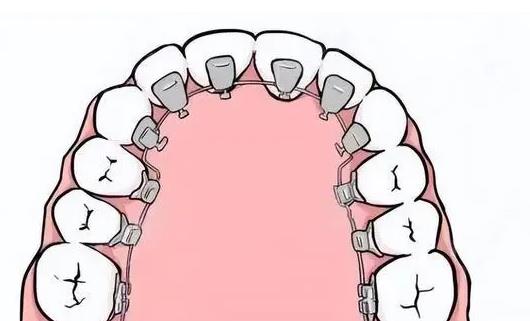 上海曙康齿科矫正怎么样？医院仪器先进吗？牙矫正价格表