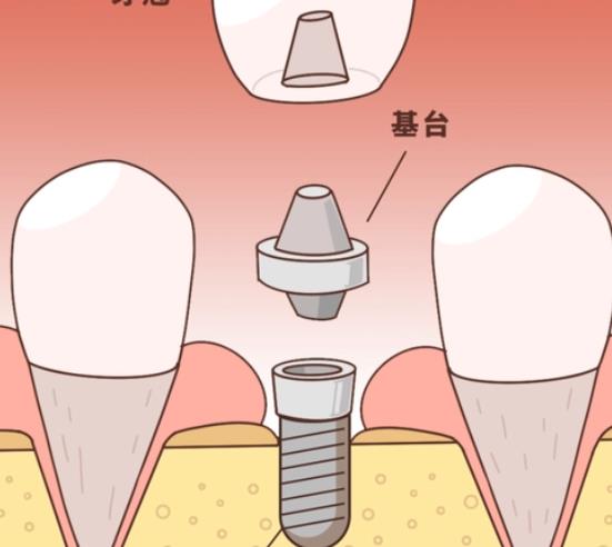 上海可恩口腔医院地址在那？医院正规吗？真实资料介绍