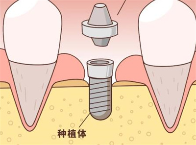 上海康态口腔种植牙怎么样?简介、专家、案例汇集在此!